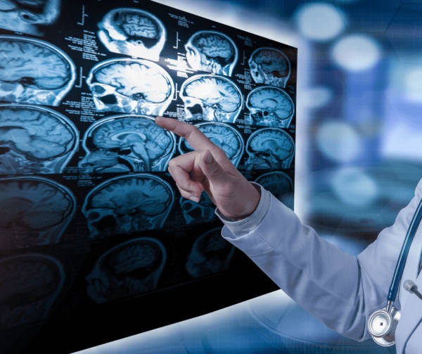 Neurochirurgia Romano di Lombardia, Bergamo, Brescia